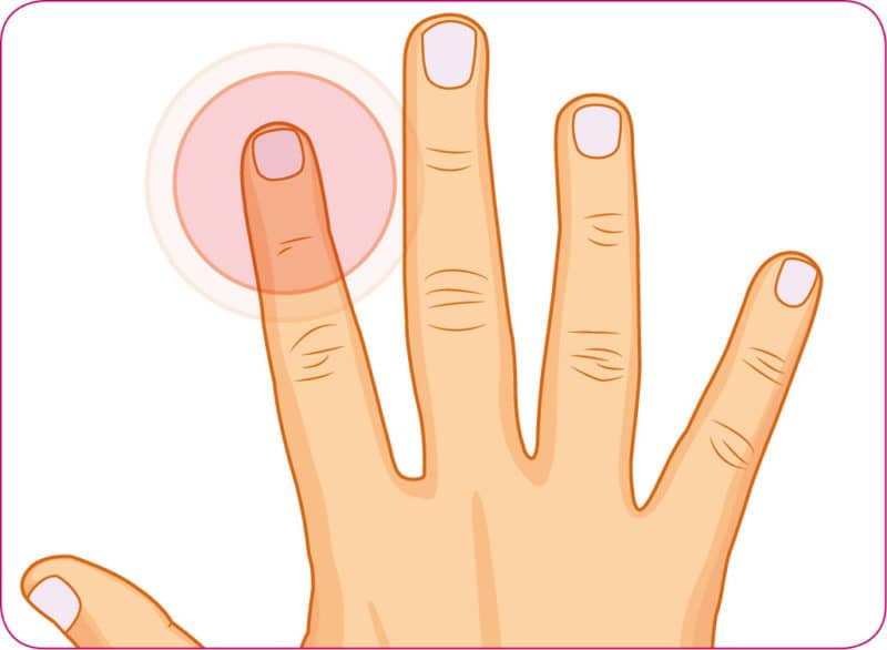 Finger nagelbettentzündung wildes fleisch Behandlung der